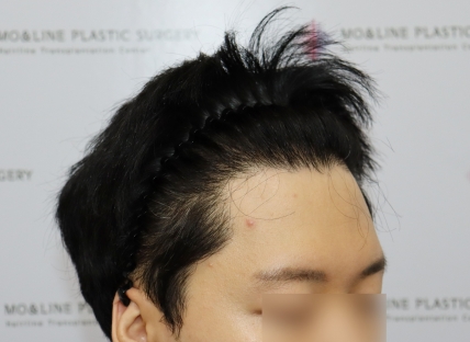 치료후기 이미지